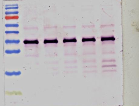 Caspase 3 and caspase 7 promote cytoprotective autophagy and the DNA damage response during non-lethal stress conditions in human breast cancer cells Caspase 3 and Caspase 7: Guardians of Cytoprotective Autophagy in Breast Cancer Cells